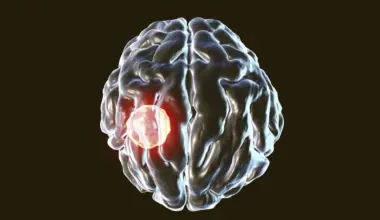 One in three people carry this brain parasite but the body has a kill switch