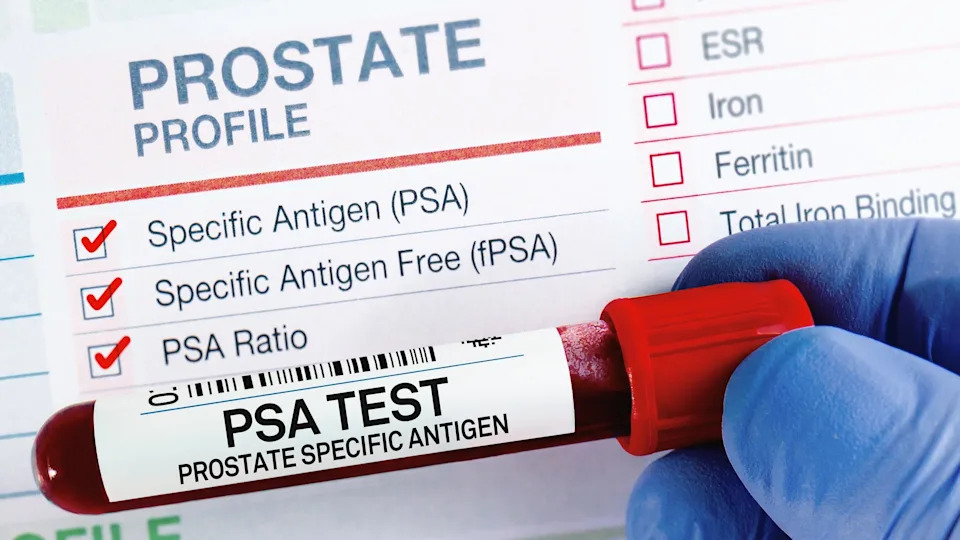 The Image shows a test tube with a label reading 'PSA TEST - Prostate Specific Antigen'. In the background is a paper that reads 'Prostate Profile', with a series of tick boxes underneath. 