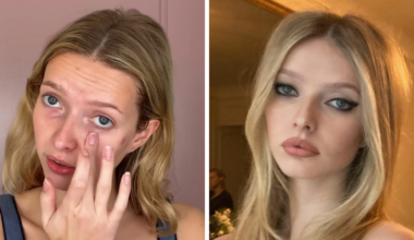 Gwyneth Paltrow's 'Nepo Baby' Apple Martin Reveals All The Cosmetic Procedures She's Had