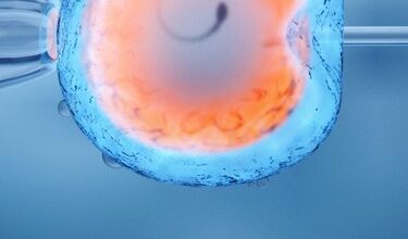 In vitro fertilization of an egg cell