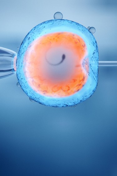 In vitro fertilization of an egg cell