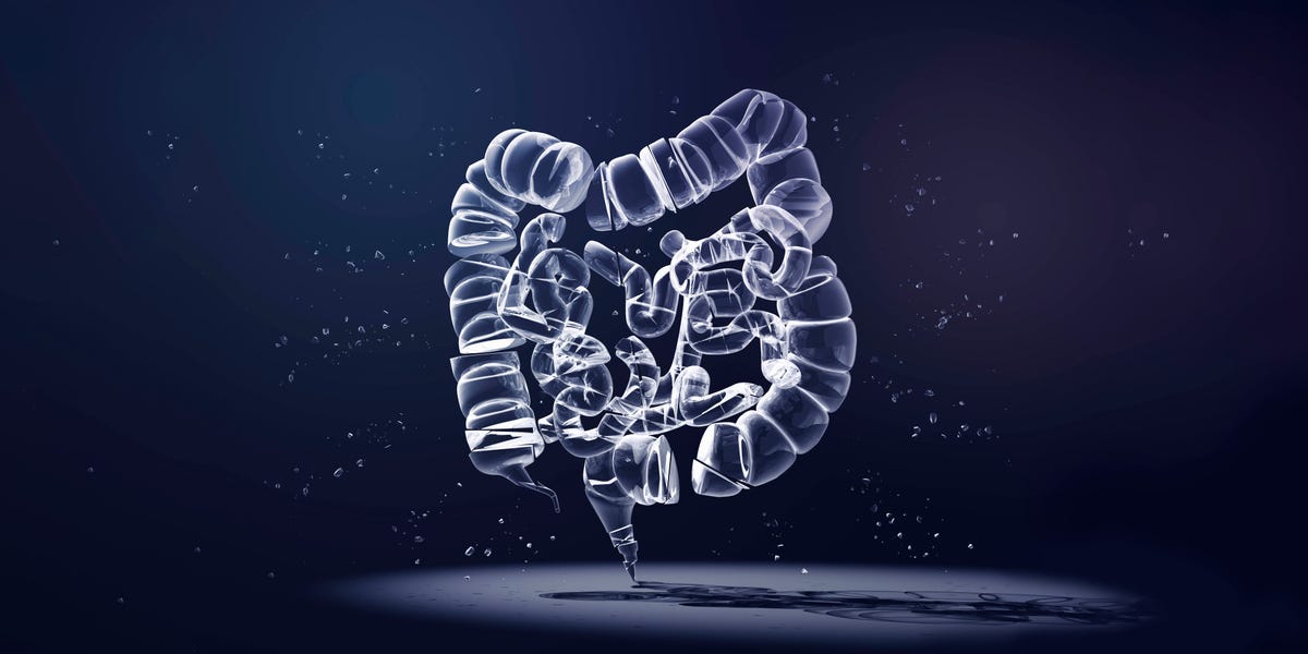 Inside the Race to Find Young-Onset Colorectal Cancer Patients Faster