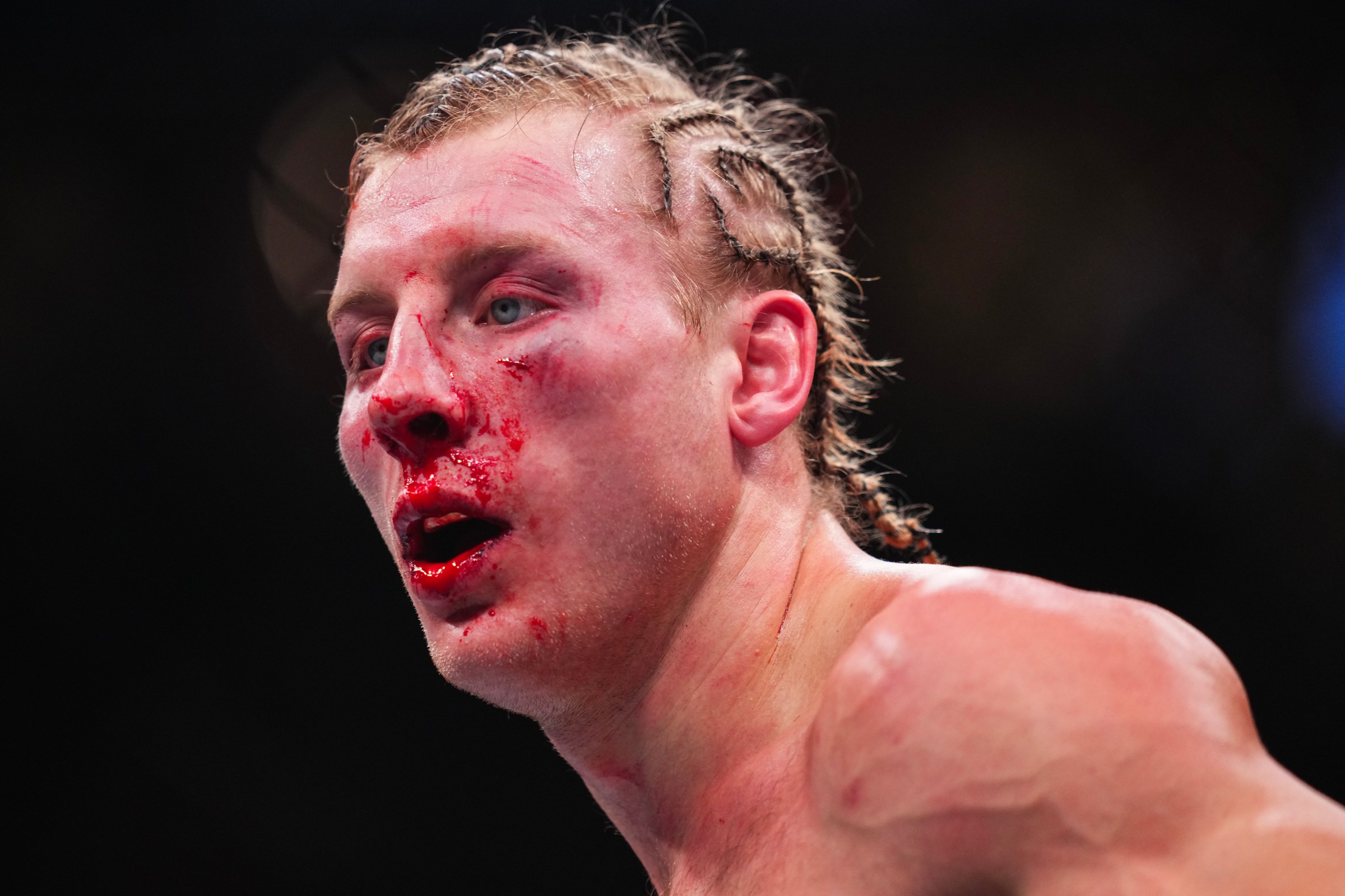 LAS VEGAS, NEVADA - JANUARY 24: Paddy Pimblett of England reacts to the end of a round in the UFC lightweight interim championship bout during the UFC 324 event at T-Mobile Arena on January 24, 2026 in Las Vegas, Nevada. (Photo by Cooper Neill/Zuffa LLC)