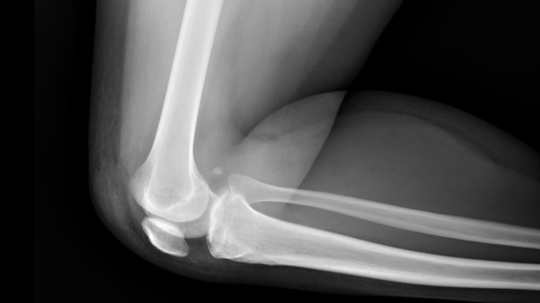 x-ray of human knee