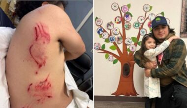 Man mauled by ICE K9 in Vancouver released from ICE custody – KIRO 7 News Seattle