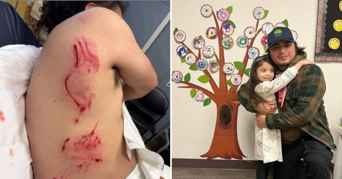 Man mauled by ICE K9 in Vancouver released from ICE custody – KIRO 7 News Seattle