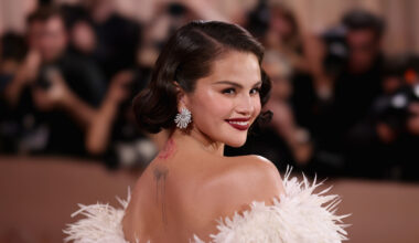 Selena Gomez's Melasma 'Mustache' Is Super Common