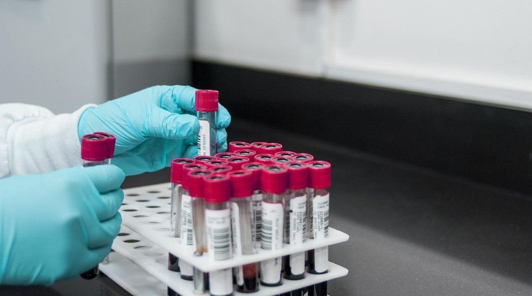 A single blood test could spot multiple cancers early, saving lives