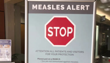 County-wide measles alert declared for Parkland County
