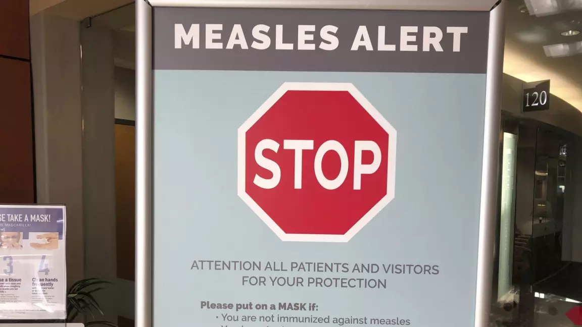 County-wide measles alert declared for Parkland County