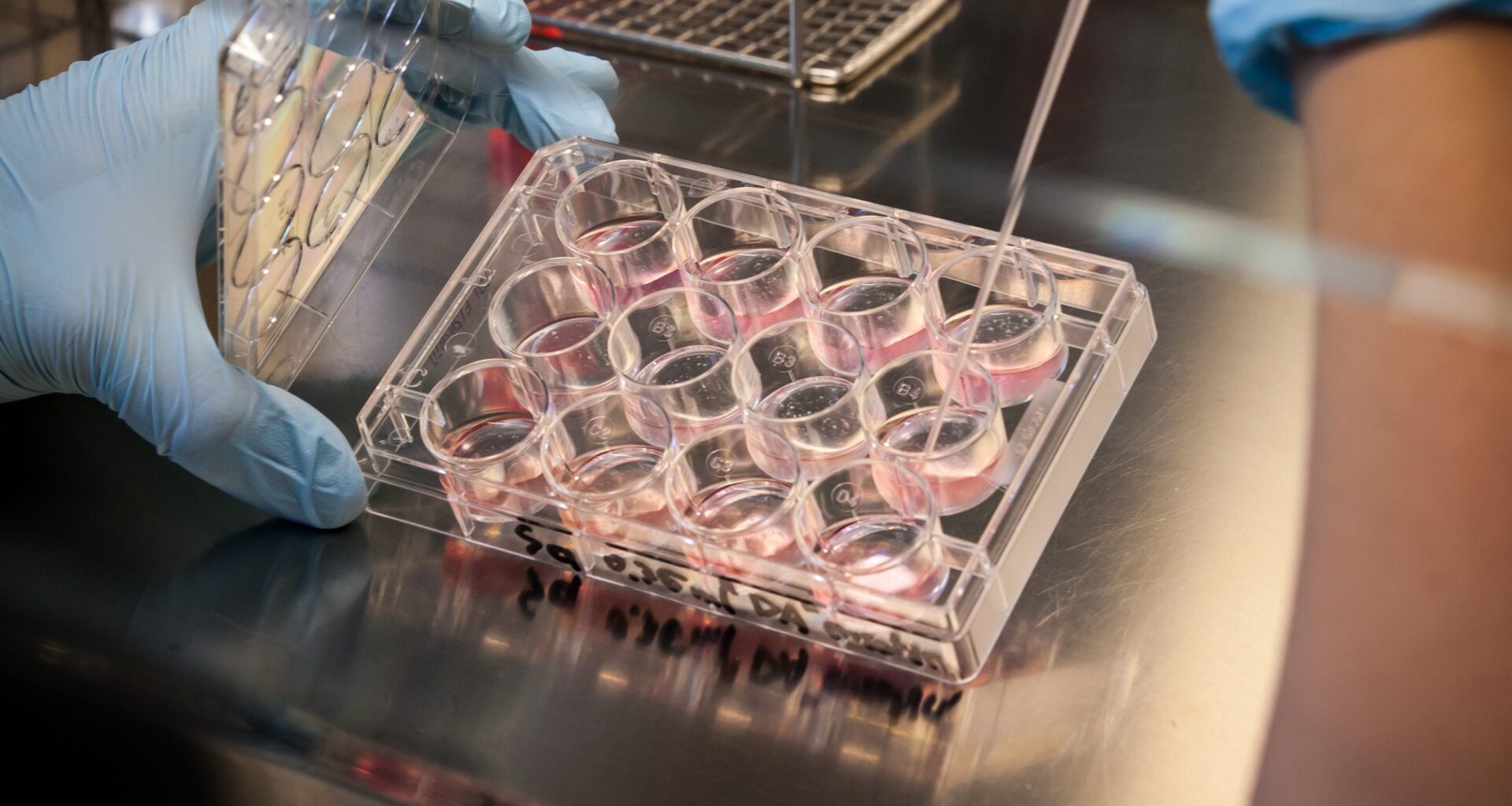 B.C. research ‘opens the door’ to more effective cancer therapies