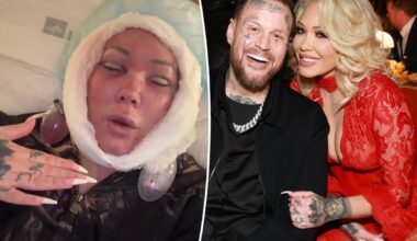 Jelly Roll's wife, Bunnie Xo, unveils gruesome aftermath of facelift
