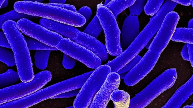 Early detection after E. coli outbreak at Calgary daycares prevented worse outcomes: study