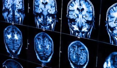 Mobile brain scans sound like science fiction. But they're now helping more Canadian patients