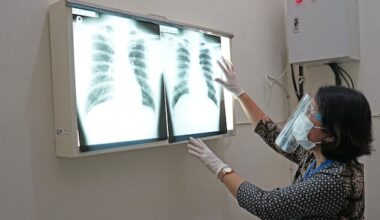 Tuberculosis outbreak in Natuashish, say NLHS, Mushuau Innu First Nation