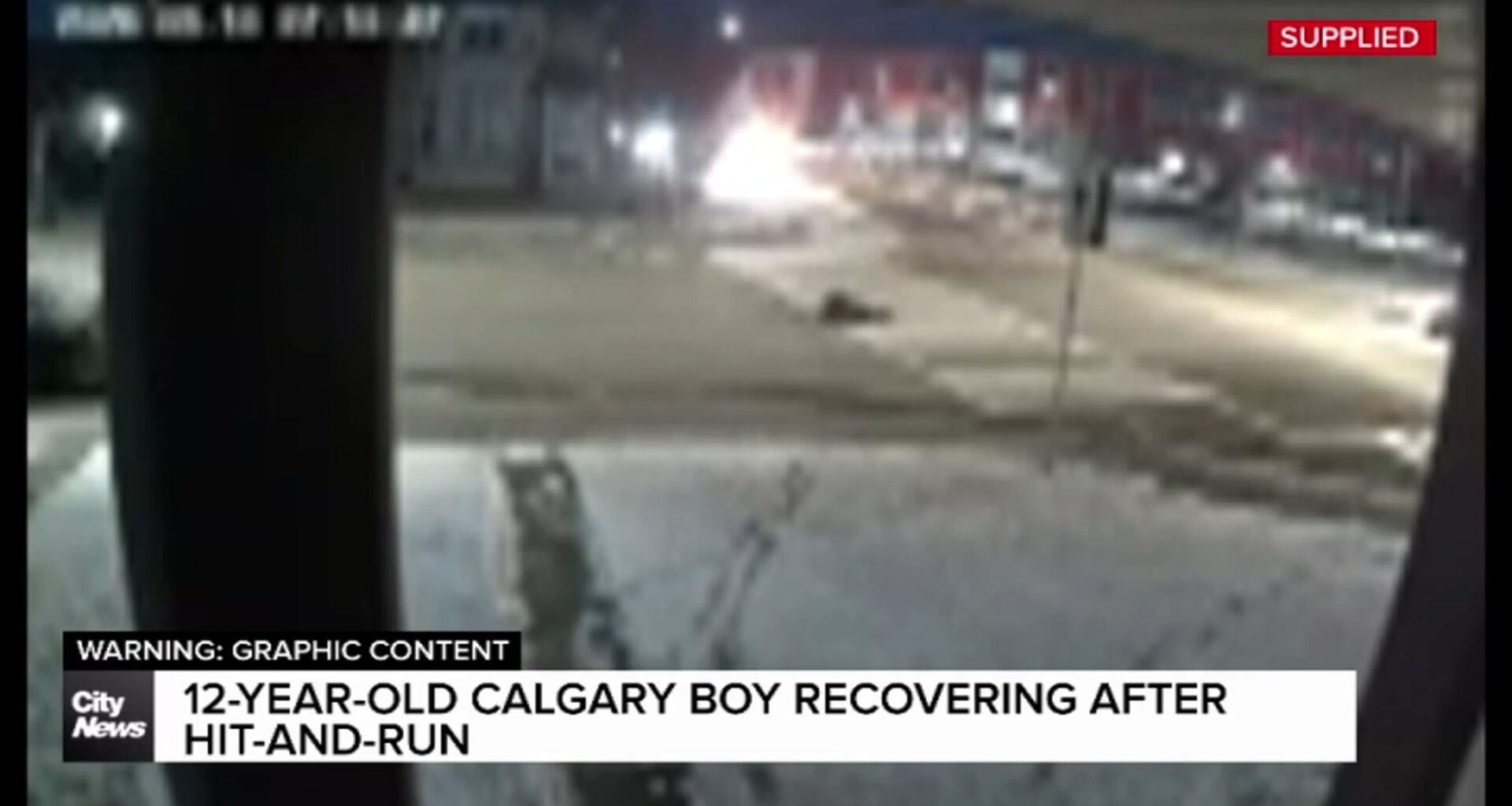 12-year-old Calgary boy recovering after hit-and-run