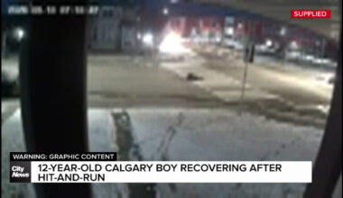 12-year-old Calgary boy recovering after hit-and-run