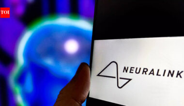 Neuralink Brain Chip : First human patient with Elon Musk's Neuralink brain chip Noland Arbaugh shares 100 days update; says: 100 days in and I already can’t ... |