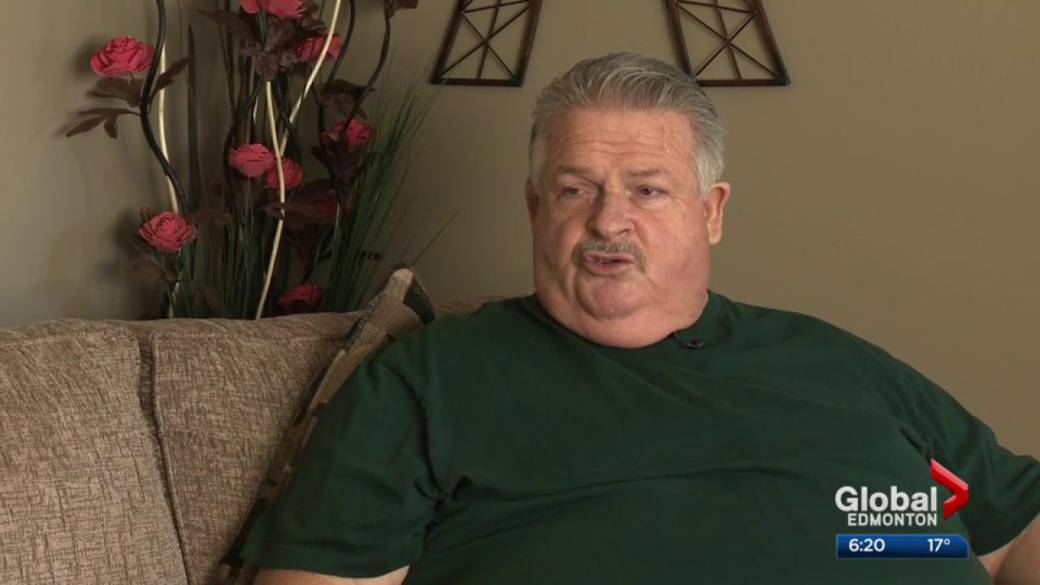 Click to play video: 'Alberta man benefits from brain surgery using gamma knife'