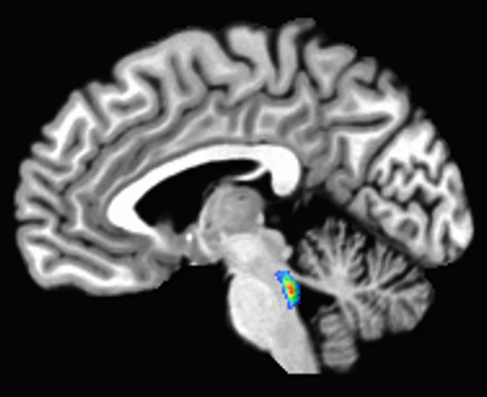 A scan of the brain with the locus coeruleus lit up in the brain stem