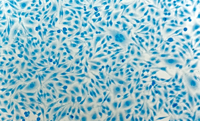 Cervical Cancer Risk in Women Living with HIV