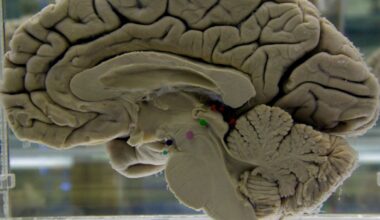 Brain ‘workouts’ like reading, puzzles may help delay dementia