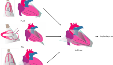 Multiview deep learning improves detection of major cardiac conditions from echocardiography