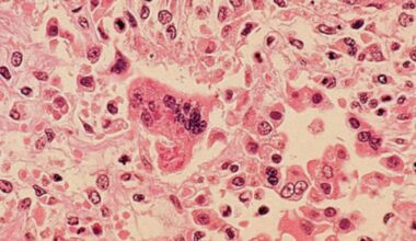 Manitoba hospital, church among new measles exposure sites - CTV News