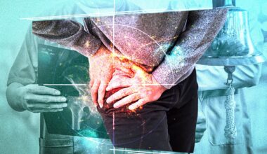 When is a patient cured of cancer? It’s debatable.