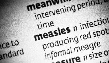 Measles exposure reportedly travelled from Calgary to Red Deer, Edmonton and Grande Prairie
