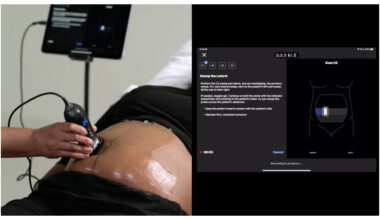 Butterfly Network Secures First FDA Clearance for Blind Sweep Ultrasound AI Tool, Marking a Major Stride for Women’s Health
