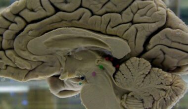 Challenging your brain helps keep it healthy. Here's how to do it