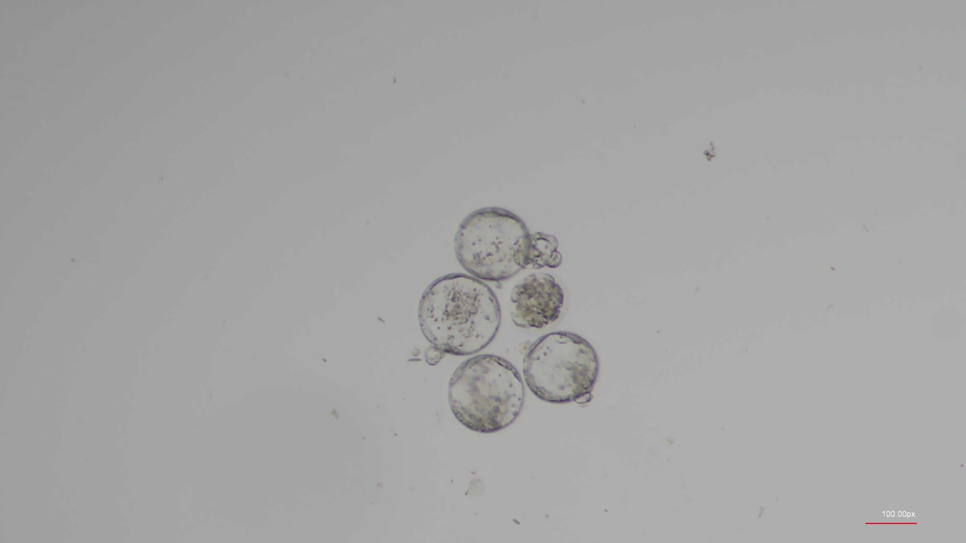 Clear circles on a gray background.