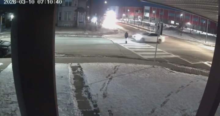 ‘Then he ran over my leg’: Calgary boy hit in crosswalk recovering at home - Calgary