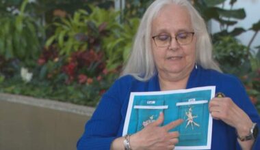 Edmonton team allows Alberta lung patient to receive care closer to home - Edmonton