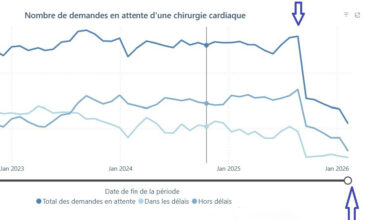 Heart surgery chart