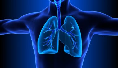 Reduce clinical trial size through pre-stratification