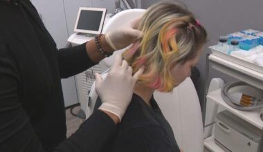 Migraine sufferers blame shifting weather for worsening symptoms