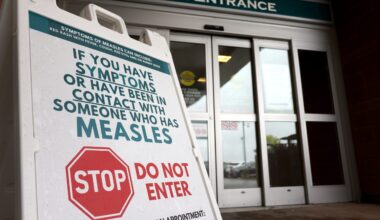 Measles exposure warning issued for Calgary airport, Alberta travel hubs