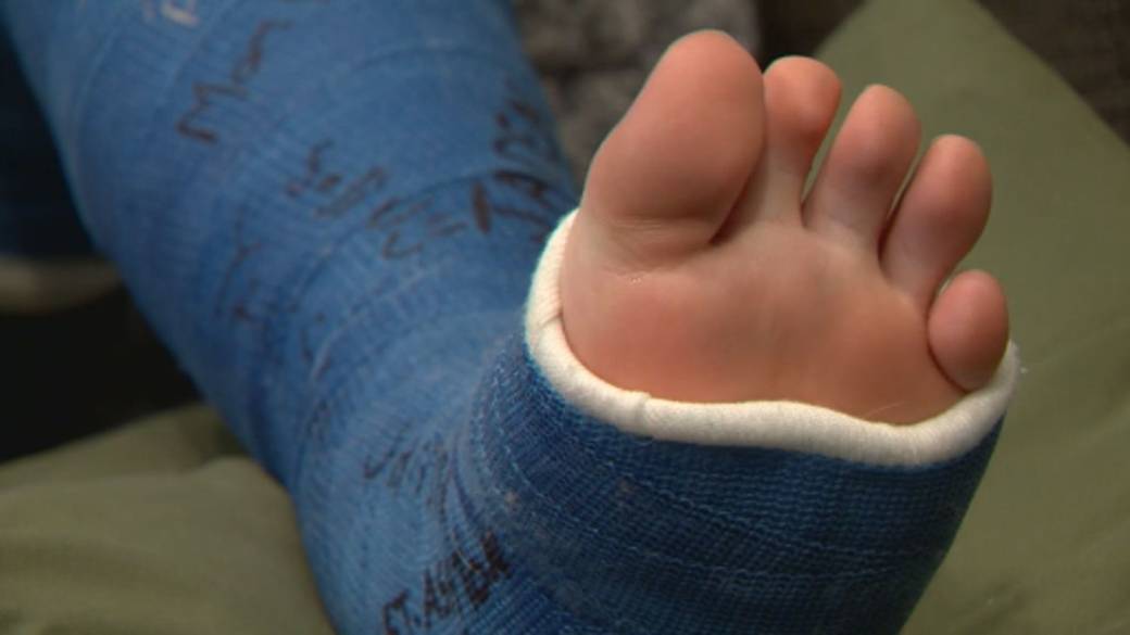 Click to play video: '12-year-old Calgary hit-and-run victim speaks out as police search for suspect’s vehicle'