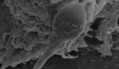 A close up of a sperm cell.