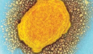 Researchers validate Mpox antibody test during outbreak in Rwanda