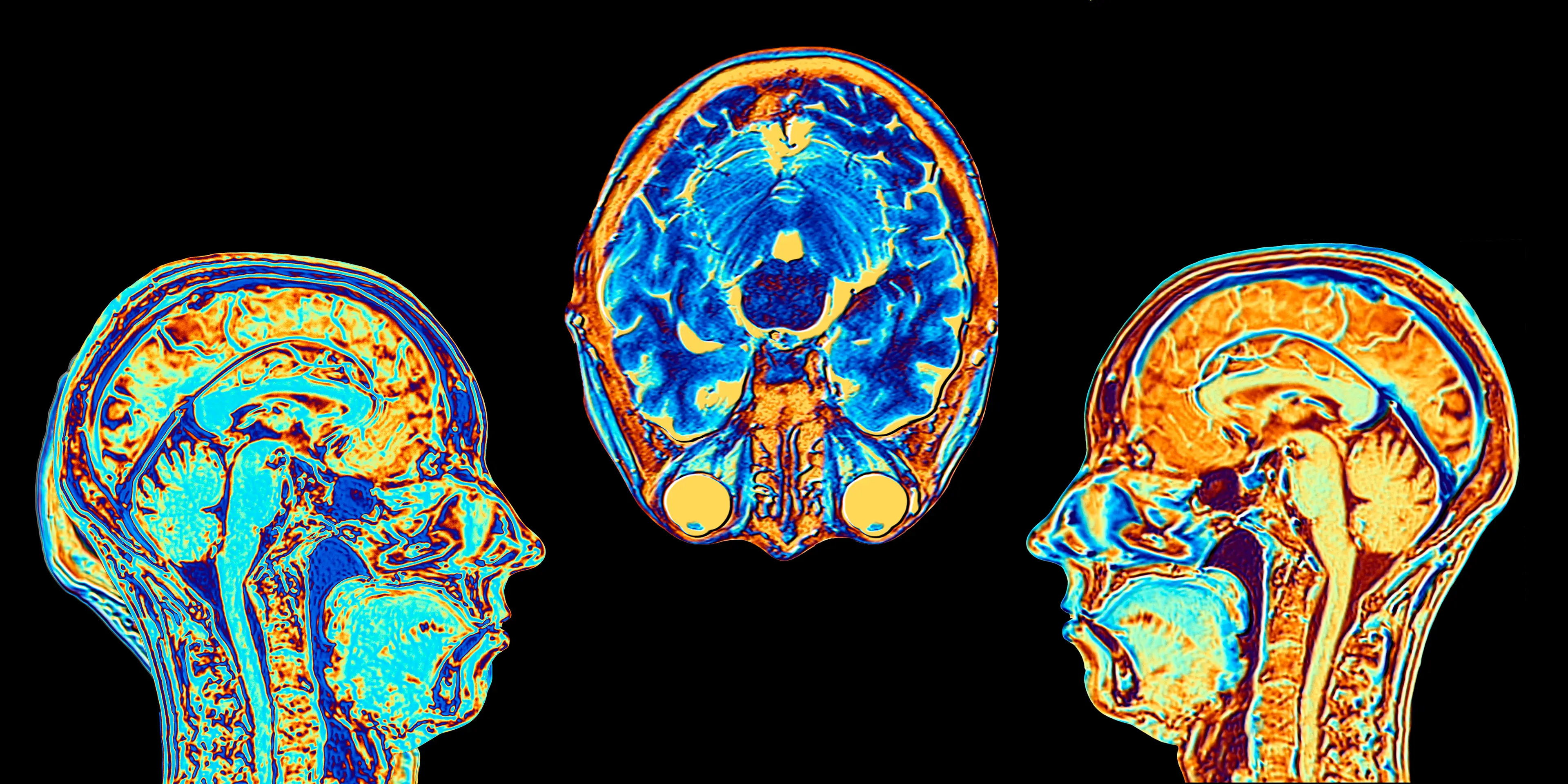A new scientific study has linked long-term cannabis use to a thinning frontal cortex (Getty Stock Image)