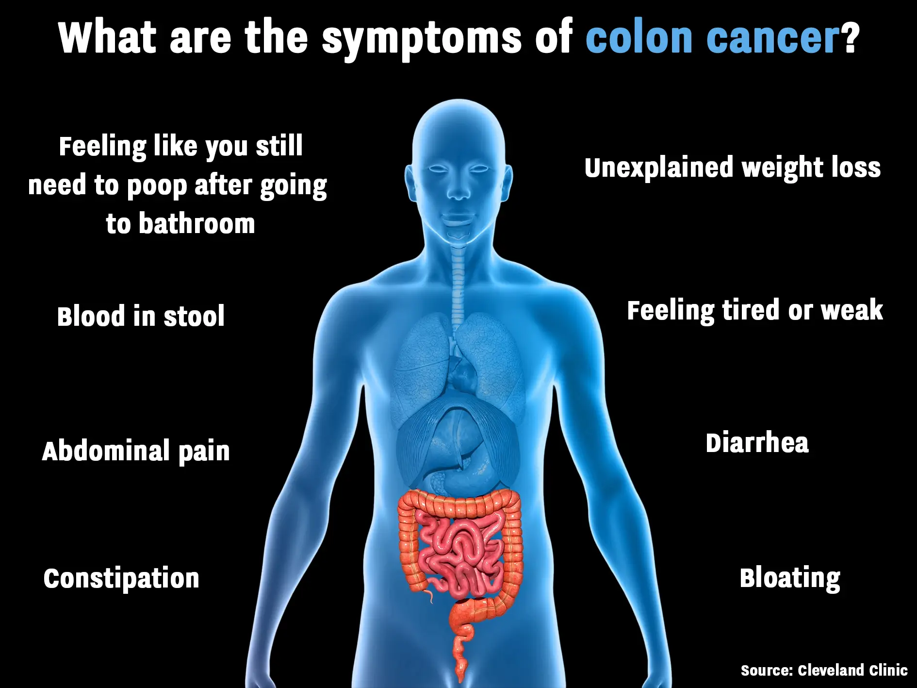Colon cancer symptoms can vary from person to person (Getty Stock Images/UNILAD)