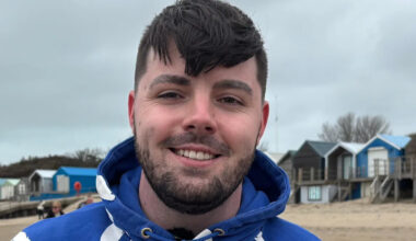 Like millions of others, I pull my own hair out - we need to talk about trichotillomania