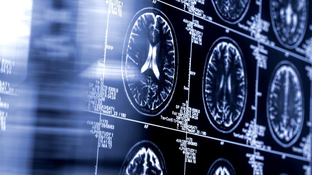 Brain scans.