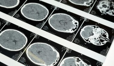 Slides showing brain scans.