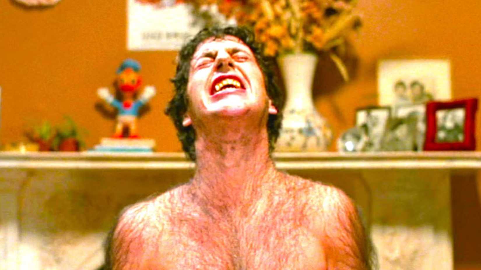 David Naughton grimacing while sprouting hairs during a werewolf transformation in An American Werewolf in London