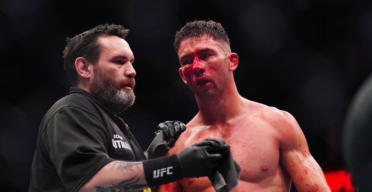 Dana White shares gruesome cut after Fight of the Year contender at UFC London