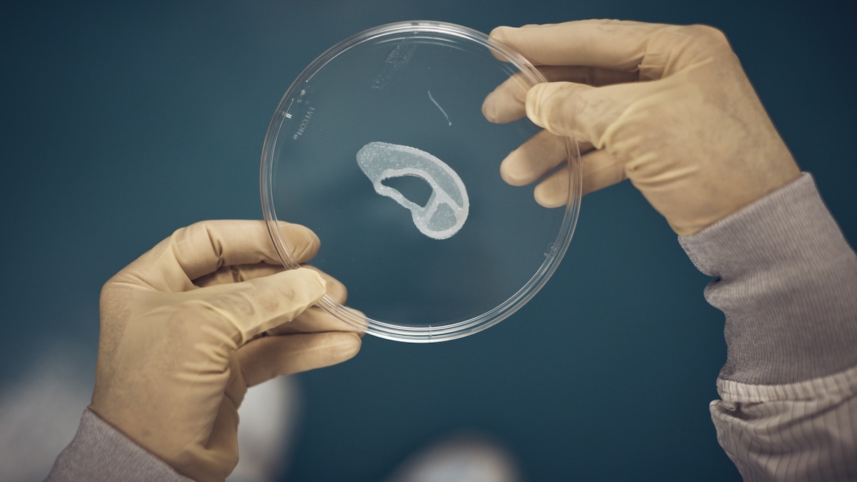 Doctors have long said cartilage can’t regenerate. They're now rethinking that.